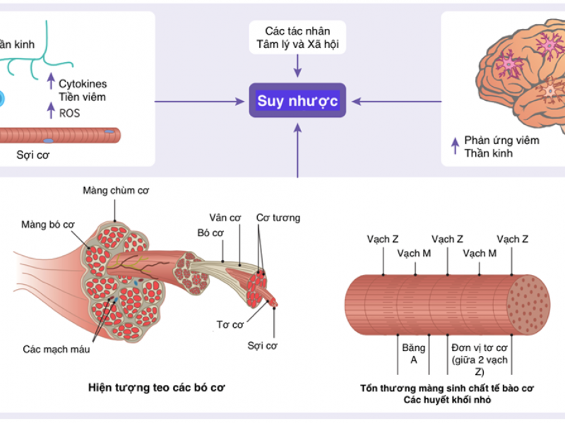 Hội chứng hậu COVID-19: Cơ chế, nguy cơ và các di chứng kéo dài